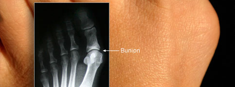 Conditions That May Require You To See A Podiatric Surgeon
