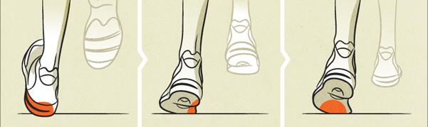 Overpronation on Your Foot Can Affect Other Parts of Your Body