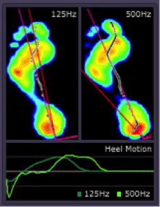 footscan