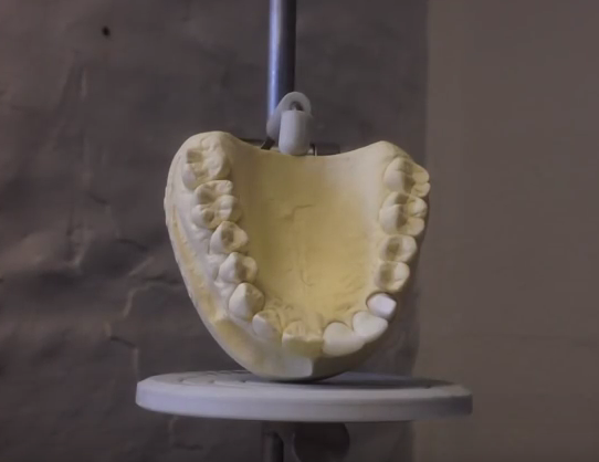 3D Printed Teeth Against Oral Bacteria