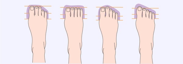 various-toe-lengths